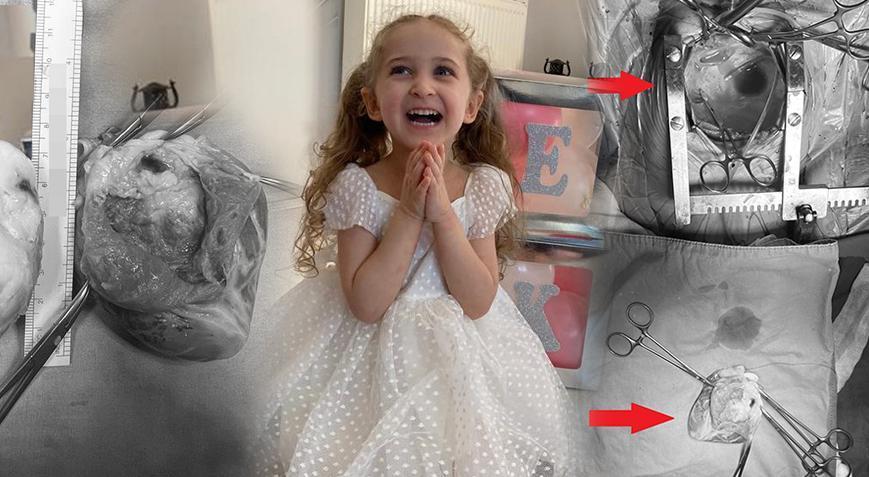 Minik kalbini ‘söküp’ tekrar yerleştirdiler! ‘Soğan kabuğu soyar gibi ayırdık’