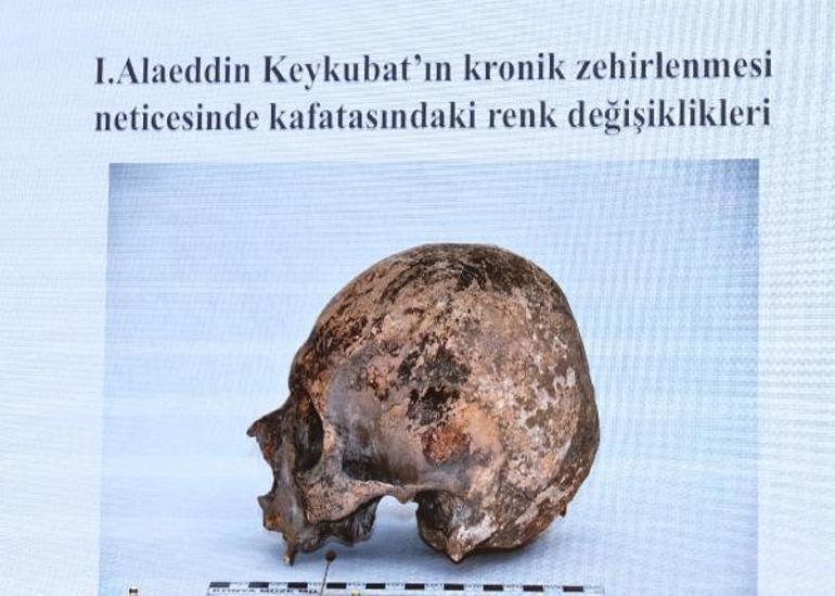 Sanduka açıldı, poşet dolusu isketler çıktı! İşte Selçuklu sultanlarının ölüm nedeni