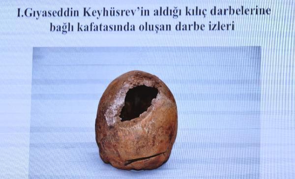 Sanduka açıldı, poşet dolusu isketler çıktı! İşte Selçuklu sultanlarının ölüm nedeni