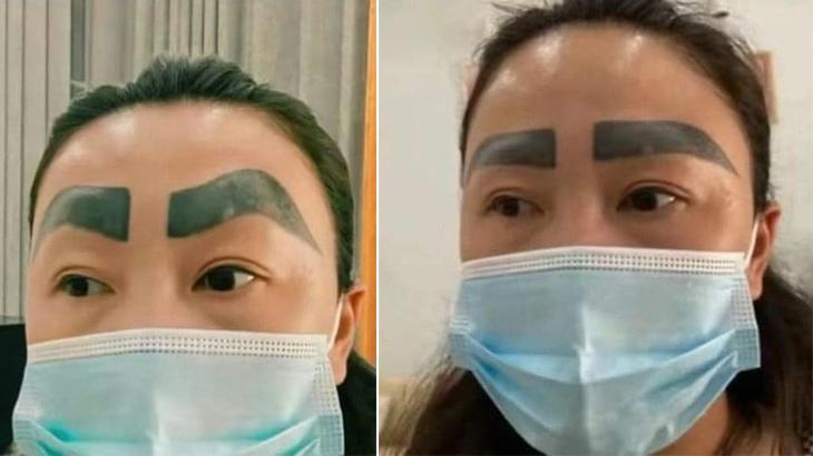 Estetik faciası! Güzel kaş hayali hüsranla sonuçlandı