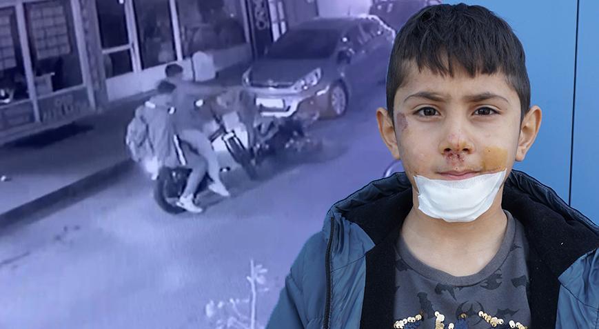 Motosikletlinin çarpıp kaçtı! 7 yaşındaki Yiğit Efe hastanelik oldu