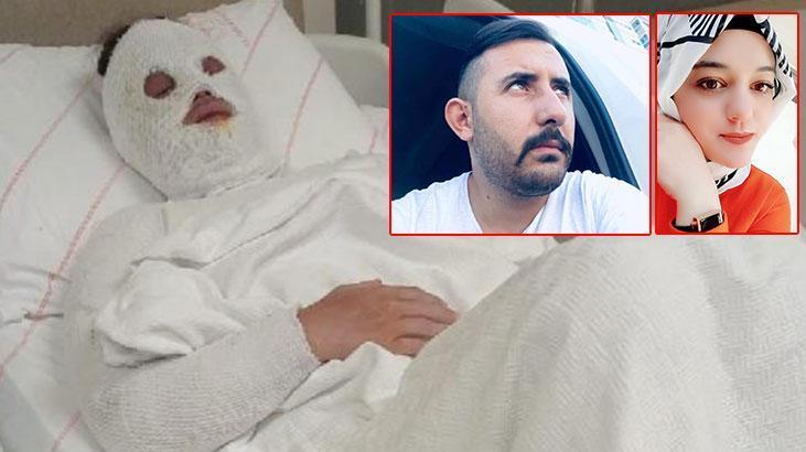 ‘Su sayacına bakacağız abla’ dedi, yüzüne kimyasal attı! 15 yıl ceza az bulundu