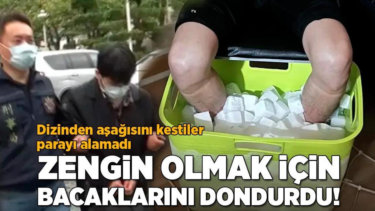 Zengin olmak için bacaklarını dondurdu! Dizinden itibaren kestiler, parayı alamadı