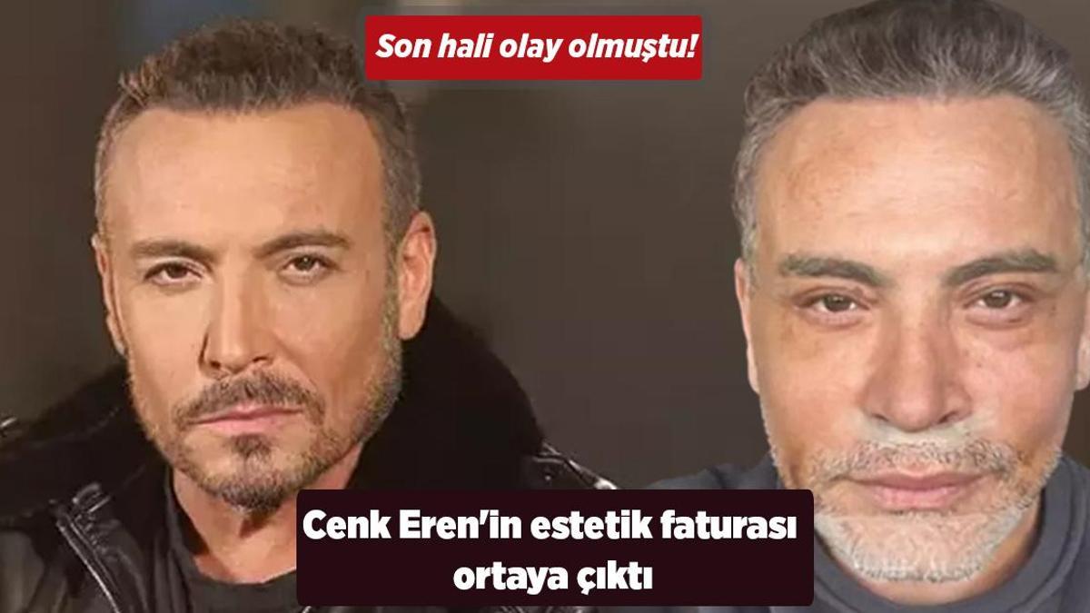 Son hali olay olmuştu! Cenk Eren’in estetik faturası ortaya çıktı