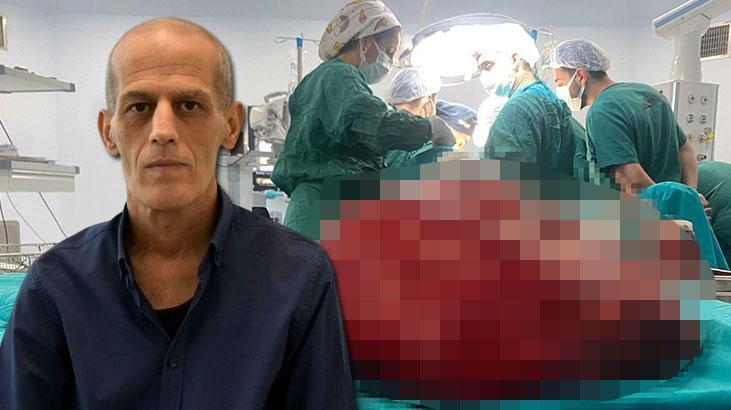 Yer: Antalya! Böbrek ağrısıyla gitti, karnından 8 kiloluk tümör çıkarıldı