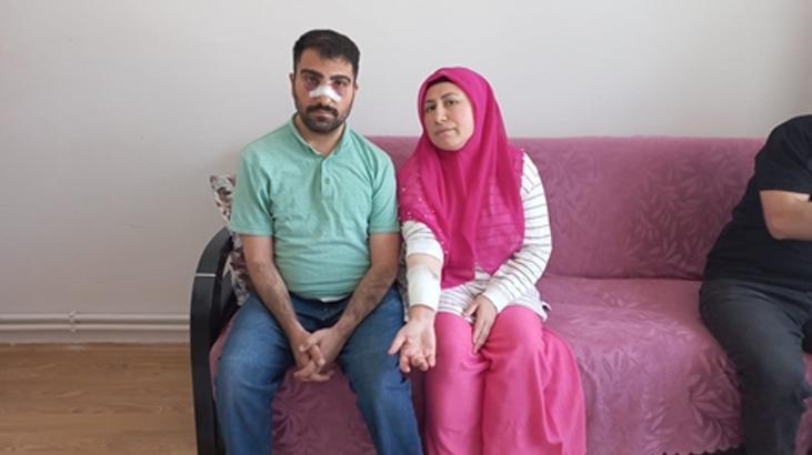 Amasya’da korkunç olay! Engelli komşusunun burnunu kırdı ve sıcak su ile yaktı