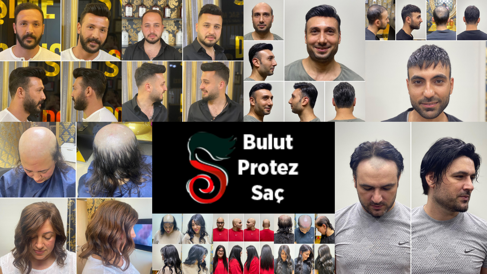 Bulut Protez Doğal Görünümlü Protez Saçlar