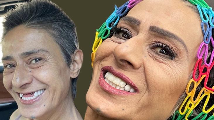 Tedavi sonrası yeni pozlar! Yıldız Tilbe dişlerini taktırdı