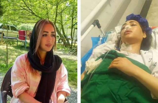 Polis Başörtüsü Yasasına Uymayan Kadını Sırtından Vurdu