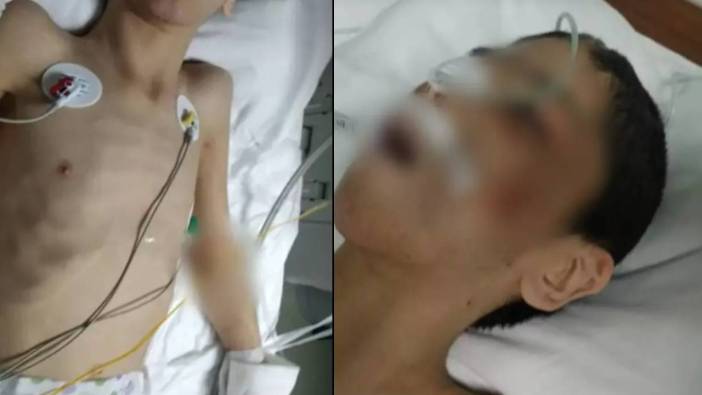 İstanbul’daki Bakımevinde Skandal: Otizmli Hüseyin’in Ölümünden Sonra Şiddet Gözler Önüne Serildi!”