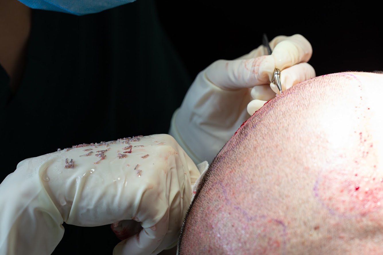 Clinista Saç Ekim Merkezi’nin Steril ve Modern Tedavi Ortamı