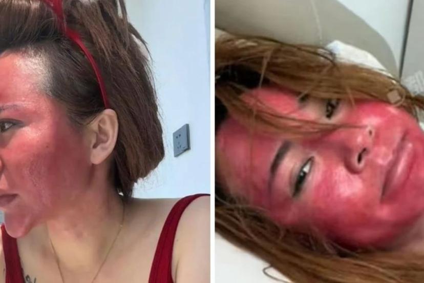 Çin’de yıllarca makyajını silmeden uyuyan kadın sağlığından oldu