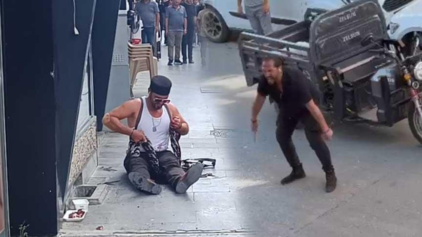 Güzellik Merkezi Sahibi Pompalı Tüfekle Yaralandı